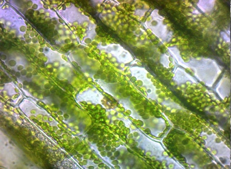 Клетки листа сфагнума под микроскопом