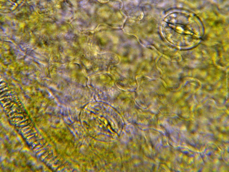 Хлороз растений под микроскопом