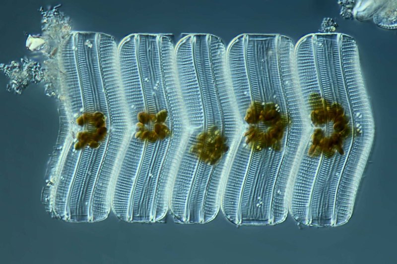 Ахнантес водоросли
