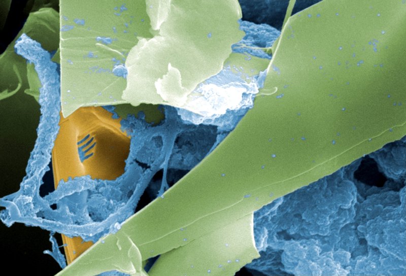 Микрофотография зубной щетки