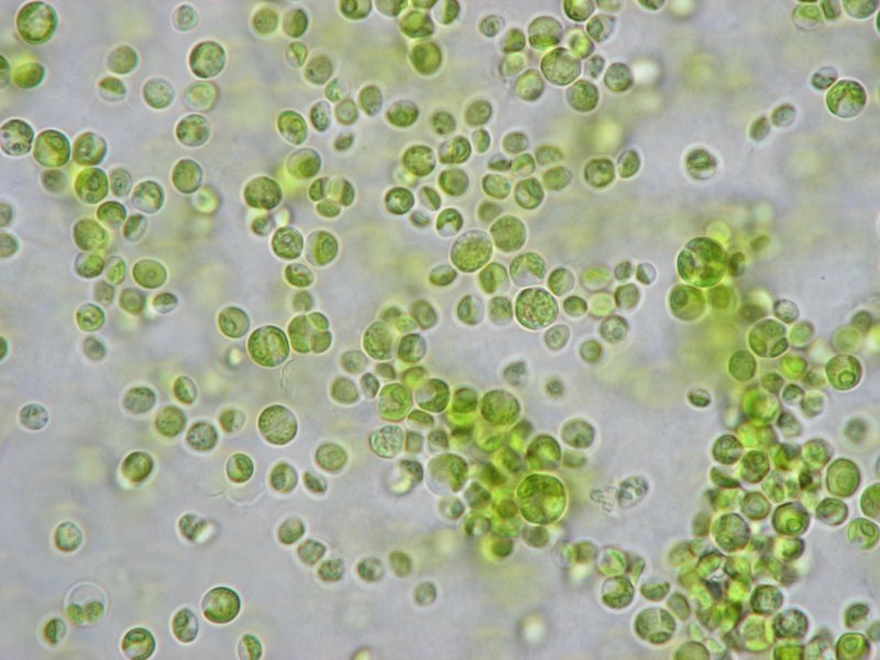 Chlorella vulgaris под микроскопом