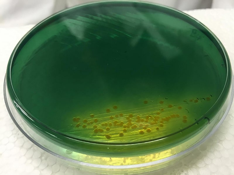 Vibrio cholerae на чашке Петри