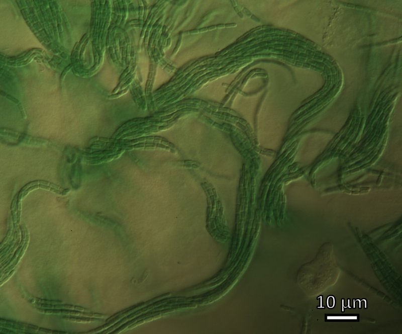 Цианобактерии водоросли
