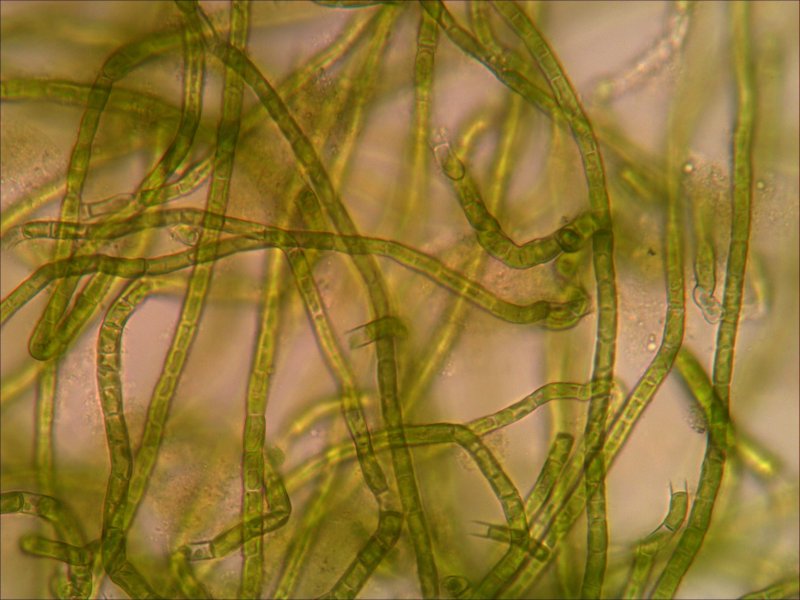 Микроскопия спирулины платенсис