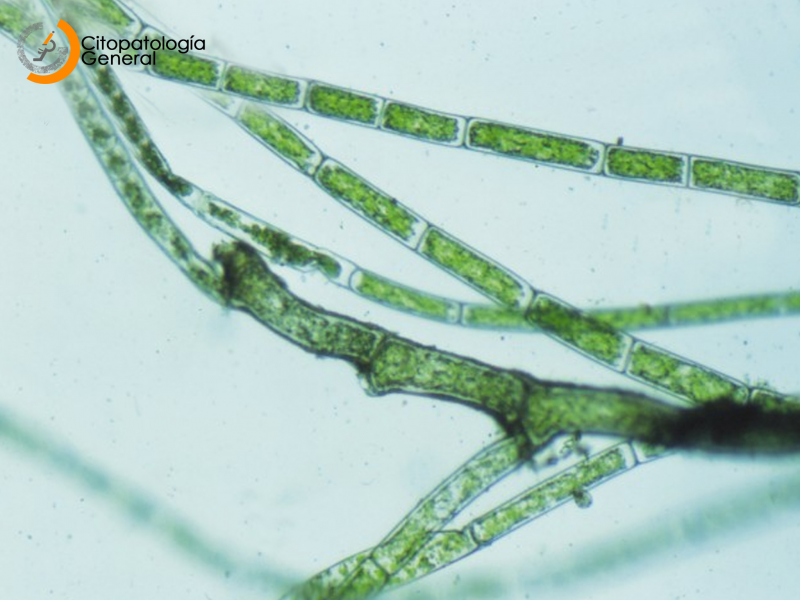 Кладофора водоросль под микроскопом