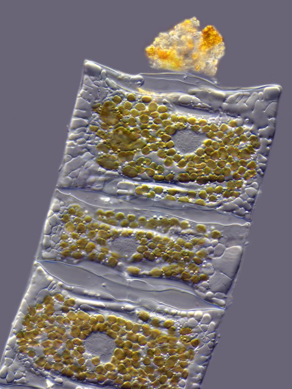 Диатомовые водоросли под микроскопом